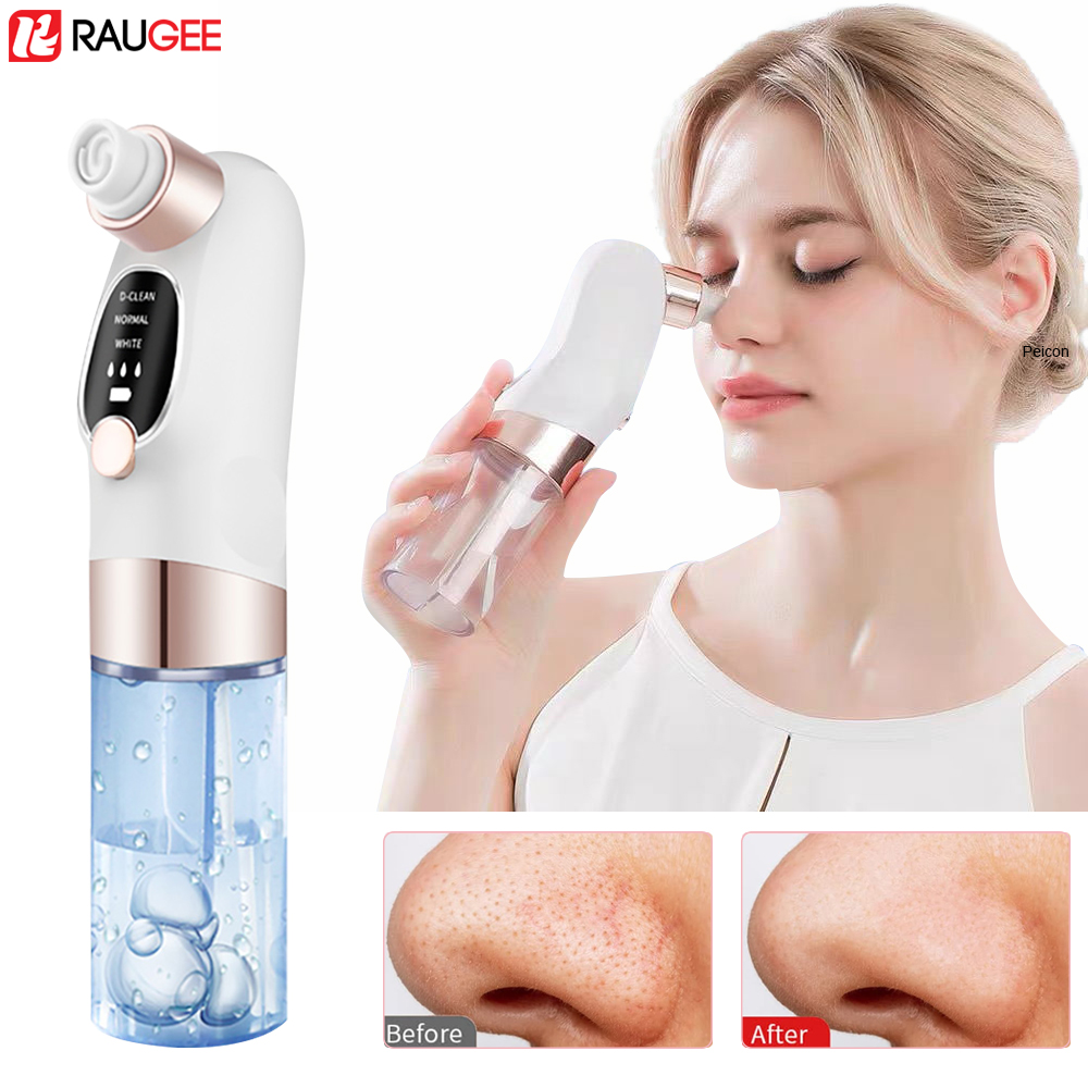 Blackhead Remover Electric Bla - Air Bubble Remover review and price